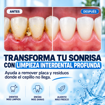 Irrigador Bucal Portátil - Limpieza y Salud